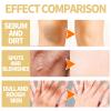 OUHOE Exfoliating Yellow Peeling Oil for Dark Skin, 1.7oz Strong OUHOE Peeling Oil Extra Strength for Exfoliating, Softening, Callus Removal, Dark Skin, Cutin, Callus Skin (1pc) view 4
