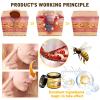 Bee Venom Comprehensive Cream, Professional Bee Venom Skin Treatment Cream, Advanced Firming & Wrinkle-Reducing cream Natural Skin Moisturizer for All Skin Types(2pcs) view 3