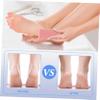 ELAYARD 4pcs Foot Stone Pumice Callus Remover Dead Skin Scraper Pedicure Tools Foot File Massager Random Color view 2