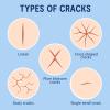 PUREEASE Moisturizing Crack Patches for Linear, Single Small Crack,for Dry,Cracked Heels,Soles, Toes Skin Relief, Hydrating Care  Flexible & Breathable, 6 Patches view 4