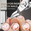 2Pcs/Set Toenail Nail Clippers Thinck Ingrown Nails Stainless Steel Straight Blade Ingrown Toenail Clipper Nail Cutter Set Tools,Black view 2