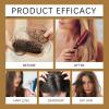 2Pcs Anti-Hair Fall Hair Loss Shampoo, Anti-Hair Fall Promote Hair Growth, Anti Hair Loss Shampoo, Moisturizing & Promoting Hair Growth, Suitable for All Hair Types (2PCS) view 3
