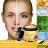 ATTDX Bee venom comprehensive Cream, Bee Venom Skin Cream,Deeply moisturizes, firms and reduces skin blemishes (4PCS) view 2