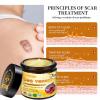 ATTDX Bee venom comprehensive Cream, Bee Venom Skin Cream,Deeply moisturizes, firms and reduces skin blemishes (4PCS) view 3