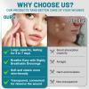 WUYUAN Pimple Patches for Face 0.66in*75in Big Acne Patches Hydrocolloid Roll Acne Pimple Patch Hydrocolloid Patch Bandages for Blemishes view 4