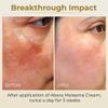 ABERA Melasma Cream (Premium Version) - Dark Spot Corrector, Melasma, Freckle, Sun Spot, Age Spot Remover Advanced Formula for Women and Men (set 3) view 4