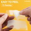 Jo Dominic MAGIX PATCH T-Zone Acne Patches Large Hydrocolloid Pimple Patches for Forehead, Nose & Chin  Absorbs Oil & Blemishes Fast  Vegan & Cruelty-Free (12 Count) view 4