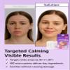 DWEasyDerm EasyDerm Quick Calming Magnesium Patches WIDE  2 Large Face Acne Patches for Breakouts, TikTok Viral Microdot, With Bonus CICA Mini Ampoule view 3