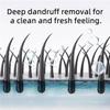 10.55 Fl.Oz Anti-Dandruff Hair Care Shampoo, Oil Control Refreshing for Men & Women, Natural Hair Shampoo (1pc-10.55 fl.oz) view 3