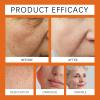 Bee Venom Skin Treatment Cream, Advanced Firming & Wrinkle-Reducing cream, Bee Venom Skin Restoration Cream, Natural Serum Suitable for All Skin Types (2 Pack) view 4