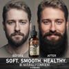 aokur Biotin Beard Growth Oil for Men - Vitamin B5 & Castor Oil Formula, Nourish & Thicken Facial Hair, Daily Beard Care, Styling & Taming, Hydrating, Non-Greasy, Sandalwood 2oz Gift for Him view 4