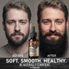 aokur Biotin Beard Growth Oil for Men - Vitamin B5 & Castor Oil Formula, Promote Thicker Fuller Beard, Daily Care, Styling & Taming, Hydrating, Lightweight Non-Greasy, Vanilla 2oz Gift for Him view 4