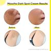 Dark Spot Corrector Cream with Kojic Acid, Alpha Arbutin & Niacinamide, 50g view 3