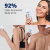 ABERA BHA Spray for Body Acne, Treats Back & Chest Breakouts, Folliculitis, Redness & Dark Spot, With Aloe, Centella, Niacinamide, Safe for All Skin Types, 3.38 Fl Oz view 3