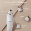 Reinvo Facial Microdermabrasion Wand by Project E Beauty | Gentle Exfoliation | Reduce Wrinkles & Fine Lines view 4