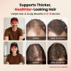 CAYAMA Red Light Hair Growth Cap  528 LEDs Full Scalp Coverage, Red Light Therapy for Hair Growth Appearance, Scalp Care for Men & Women view 2