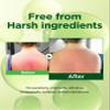 A'SOME After Sun Aloe Soothing Gel Korean Multi-Purpose Cooling Moisturizer with 99% Aloe Vera and Cica for Face Hair & Body for Dry Sensitive Skin, Non-Sticky Formula Free from Parabens, 6.8fl.oz view 3