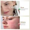 kingdo 4-in-1 Microdermabrasion Machine, At-Home Diamond Exfoliation & Pore Cleansing Device with Adjustable Suction, Replaceable Tips for Facial Skin Care view 2