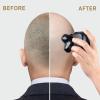 Telfun Detachable Head & Body Hair Shaver, Magnetic Electric Razor for Fast Shaving view 4