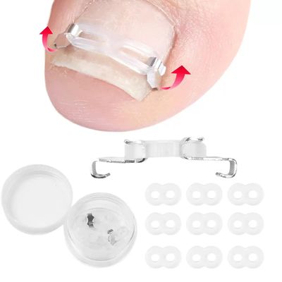 Ingrown Toenail Corrector Kit: Stainless Steel Clips & Silicone Strips for Pain Relief - Toenail Treatment for Curved Nails, Pedicure Tool Set (2 Clips + Strips)