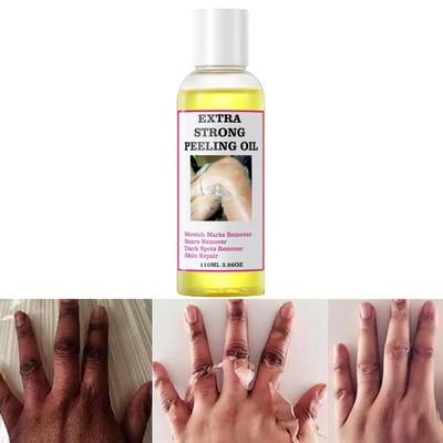 Chemical Peel Oil for Face & Body, Extra Strong Yellow Peeling Oil for