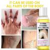 Chemical Peel Oil for Face & Body, Extra Strong Yellow Peeling Oil for view 2