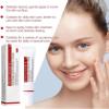  and Anti-Freckle Cream, Freckle Cream, Acne Scar Removal Treatment , Pigmentation Removal  for Face,Moisturizes and Brightens Skin (1) view 3