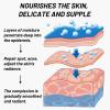  and Anti-Freckle Cream, Freckle Cream, Acne Scar Removal Treatment , Pigmentation Removal  for Face,Moisturizes and Brightens Skin (1) view 4