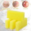 Batiyeer 100 Pcs Pumice Stone for Feet Scrubber Dead Skin Disposable Pedicure Pumice Stone Foot Shower Scrubber for Heel Cuticle Callus Remover Bath Spa(Yellow) view 3