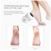 ARTSEWPLY 10Pcs Replaceable Grinding Heads for Electric Foot File and Foot Care Accessories Dead Skin Remover Professional Design for Home view 2