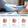 Moisturizing Socks,Moisturizing Heel Socks for Dry Cracked Feet Repair Treatment Overnight(Blue,OneSize) view 4