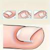 20 Ingrown Toenail Correction, Toenail Straightener Strips and Recovery Tool view 2