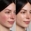 MIERU Epishield Hydrating Serum view 2