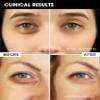 TTLALA Eye Cream with 6% High-purity Caffeine & 1% Bakuchiol, Under Eye Cream for Dark Circles, Puffiness, Fine Lines, Anti Aging, Wrinkles, Eye Bags Treatment for Women & Men with 360 Roller, 0.57oz view 2
