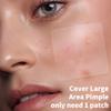 Daolyo Large Pimple Patches for Face, 8 Sizes 400 Counts XL Acne Patches, Big Hydrocolloid Bandages for Body, Chin, Forehead, Chest, Back Zit Breakouts (Strip, Square, Round, Moon) view 3