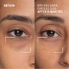 Dr. Brandt Bye Bye Dark Circles Duo - Includes No More Baggage (0.5 oz) & Bright This Way 24/7 Retinol Eye Cream (0.5 fl oz) view 2