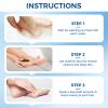 OUKEYA Urea Cream 40 Percent Tube, Urea Cream 40 Percent For Feet Maximum Strength, with Foot Callus Remover, Nano Glass Foot File view 2