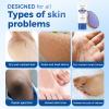 OUKEYA Urea Cream 40 Percent Tube, Urea Cream 40 Percent For Feet Maximum Strength, with Foot Callus Remover, Nano Glass Foot File view 3