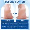 OUKEYA Urea Cream 40 Percent Tube, Urea Cream 40 Percent For Feet Maximum Strength, with Foot Callus Remover, Nano Glass Foot File view 4