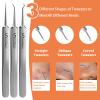 2026 Professional Pimple Popper Tool Kit, 20 PCS Blackhead Remover ToolsBlackhead Remover Comedone Extractor Tools for Removing Zit on Face - Acne Removal Kit with Metal Case (Silver) view 4
