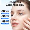 Pore Texure Pad - 70 Count (5.46oz),AHA & BHA, Deep Cleansing & Pore Refining, Pore Fresh Peeling Pads for Oily & Acne-Prone Skin view 4