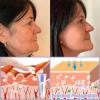 ATTDX Jorondy Anti-Wrinkle Skin Cream for Remove Wrinkles, Firms Skin,Effectively lifts, firms and revitalizes the skin (3PCS) view 2