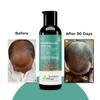 A'VIMEE HAIR OIL |Keshpallav Hair Oil | Promotes Hair Growth & Reduces Hair Fall | With Rosemary, Castor, Amla, Coconut and Bhringraj Oil | Hair Oil For Men & Women 100ml view 3