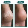 JANE VINE Kissable Feet, Athletes Foot Cream  Cream for Itchy, Dry Skin  Tea Tree, Coconut & Chamomile  Crafted for the Whole Family, No Sting  3.5 oz view 2