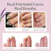 CLINICALLY PROVEN for Weak, Brittle, Damaged Nails | 100% Natural Nail Repair Balm | Doctor Developed to Strengthen Nails Damaged by Gel or Nail Salon Manicures, Menopause & Aging | Made in the UK view 2