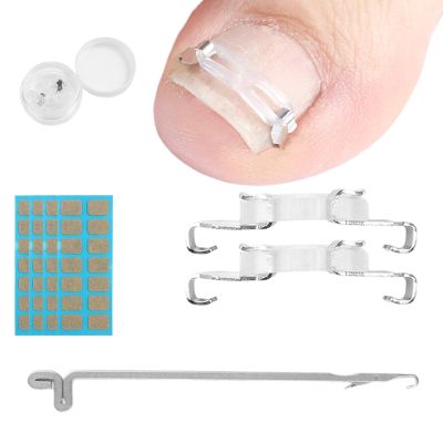 JIUDOUCUOIngrown Toenail correction Kit, Professional Nail Care Tools with Correction Clips and Adhesive PadsFour correction clips can correct two toenails simultaneously