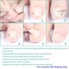 JIUDOUCUOIngrown Toenail correction Kit, Professional Nail Care Tools with Correction Clips and Adhesive PadsFour correction clips can correct two toenails simultaneously view 4