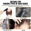 2Pcs Root Activator Shampoo - Hair Growth Root Activator Shampoo for Men and Women - Natural Formula for Hair Loss and Thinning Hair view 4