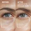 Dr. Brandt Under Eye Rescue Duo - Includes No More Baggage (0.5 oz) & iD-STRESS Fatigue Fighting Eye Gel (0.5 oz) view 2