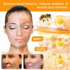 Bee Venom Skin Restoration Cream, Professional Bee Venom Skin Treatment Cream, bee venom Repair cream, Natural Ingredients Suitable for All Skin Types (2 Bottle) view 2